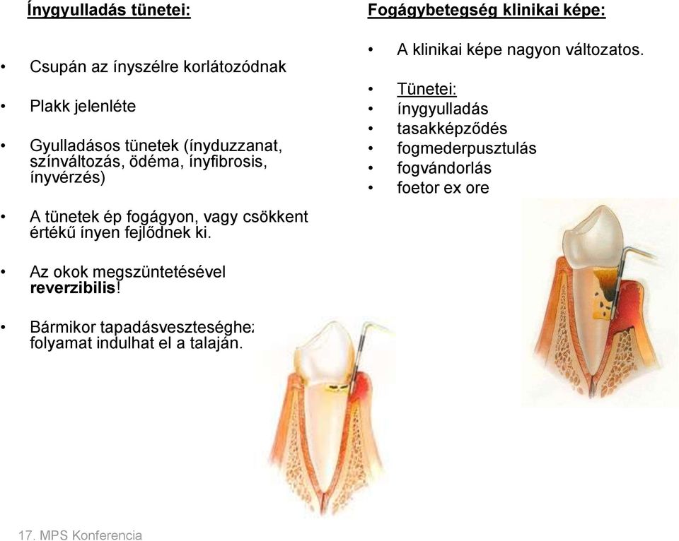 Fogágybetegség klinikai képe: A klinikai képe nagyon változatos.