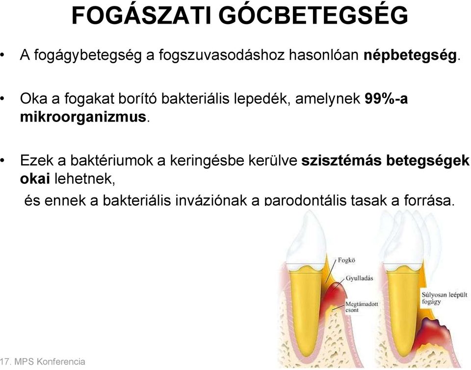 Oka a fogakat borító bakteriális lepedék, amelynek 99%-a mikroorganizmus.