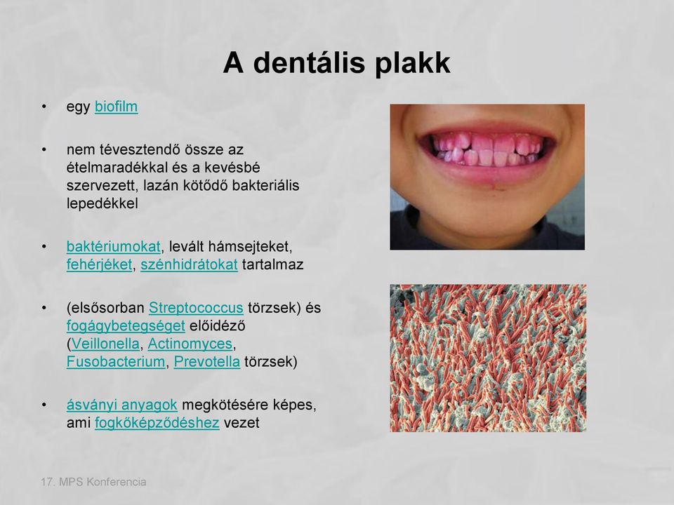 tartalmaz (elsősorban Streptococcus törzsek) és fogágybetegséget előidéző (Veillonella,