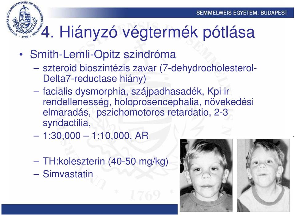 Kpi ir rendellenesség, holoprosencephalia, növekedési elmaradás, pszichomotoros