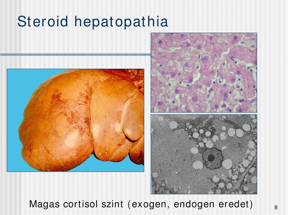 Magas cortisol