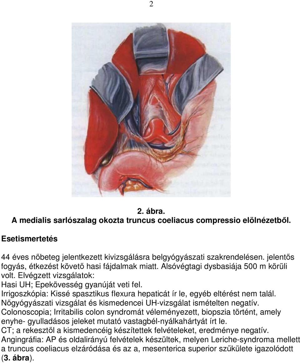 Irrigoszkópia: Kissé spasztikus flexura hepaticát ír le, egyéb eltérést nem talál. Nıgyógyászati vizsgálat és kismedencei UH-vizsgálat ismételten negatív.