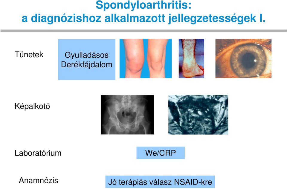 Tünetek Gyulladásos Derékfájdalom