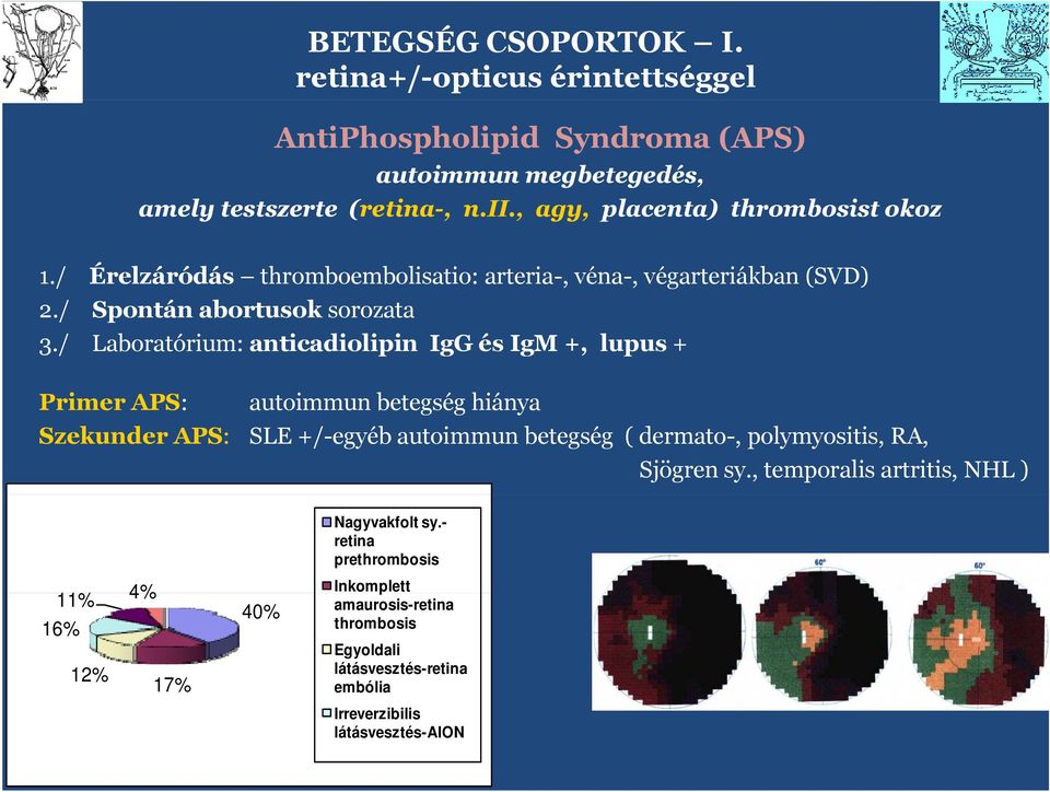 / Labratórium: anticadilipin IgG és IgM +, lupus + Primer APS: autimmun betegség hiánya Szekunder APS: SLE +/-egyéb autimmun betegség ( dermat-, plymysitis,