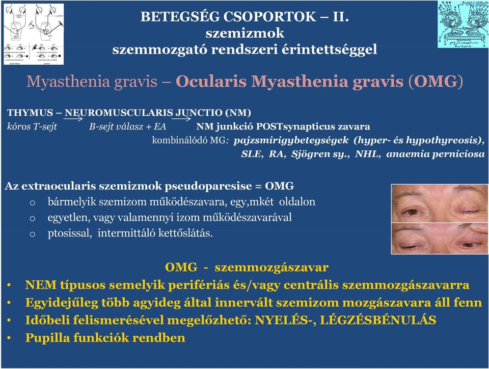 POSTsynapticus zavara kmbinálódó MG: pajzsmirigybetegségek i (hyper- és hypthyresis), SLE, RA, Sjögren sy.