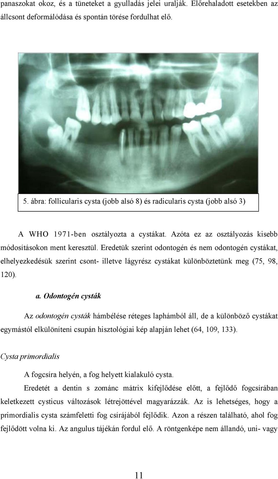 Eredetük szerint odontogén és nem odontogén cystákat, elhelyezkedésük szerint csont- illetve lágyrész cystákat különböztetünk meg (75, 98, 120). a.