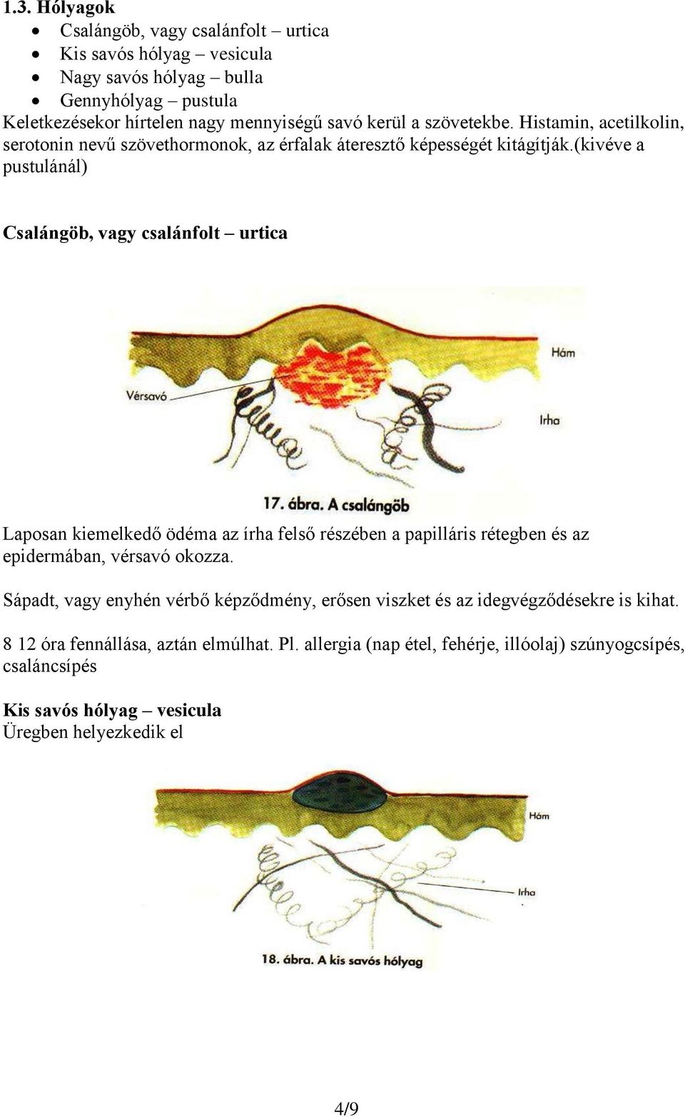 (kivéve a pustulánál) Csalángöb, vagy csalánfolt urtica Laposan kiemelkedő ödéma az írha felső részében a papilláris rétegben és az epidermában, vérsavó okozza.
