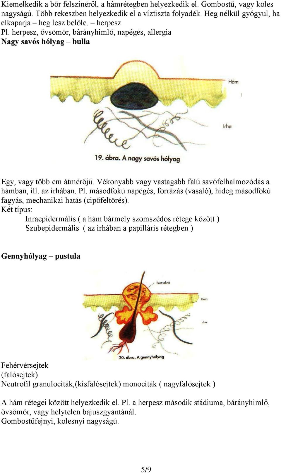 Két típus: Inraepidermális ( a hám bármely szomszédos rétege között ) Szubepidermális ( az irhában a papilláris rétegben ) Gennyhólyag pustula Fehérvérsejtek (falósejtek) Neutrofil