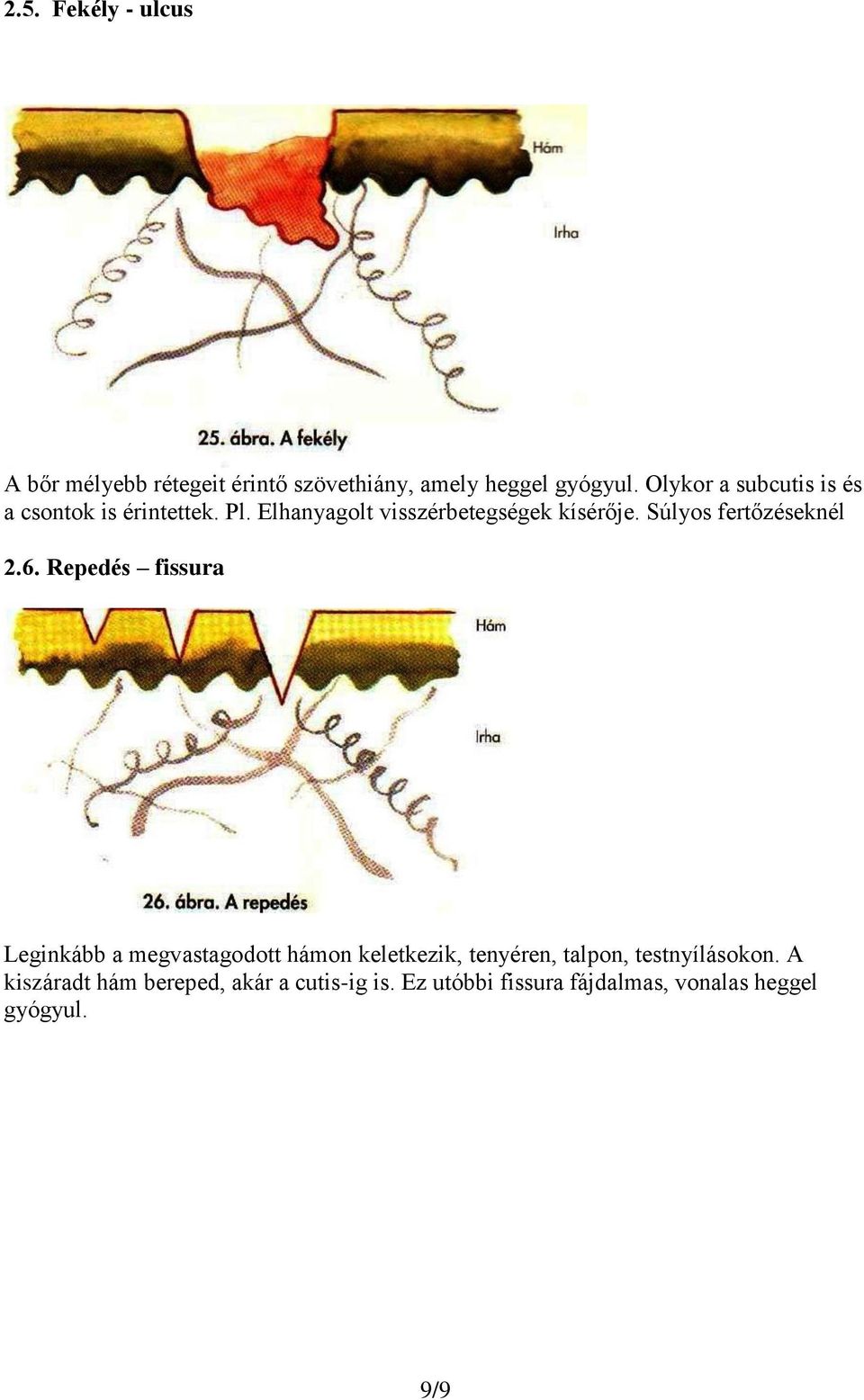 Súlyos fertőzéseknél 2.6.