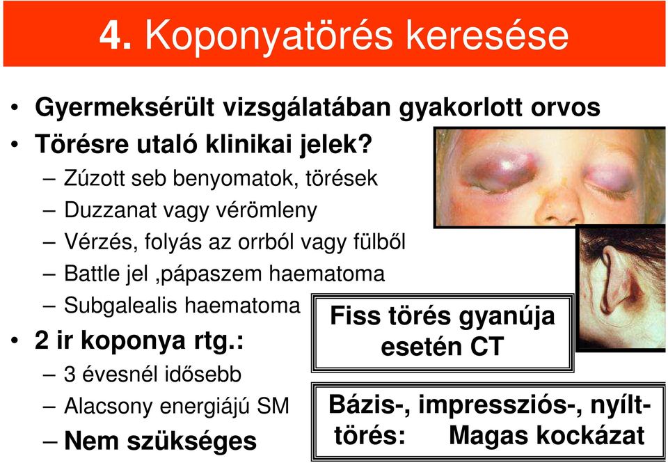 jel,pápaszem haematoma Subgalealis haematoma 2 ir koponya rtg.