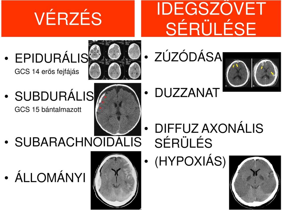 SÉRÜLÉSE ZÚZÓDÁSA DUZZANAT