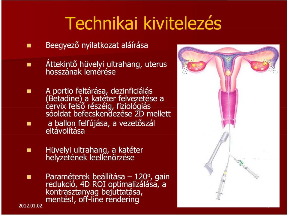 mellett a ballon felfújása, a vezetőszál eltávolítása Hüvelyi ultrahang, a katéter helyzetének leellenőrzése Paraméterek