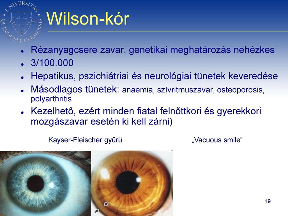 anaemia, szívritmuszavar, osteoporosis, polyarthritis Kezelhető, ezért minden fiatal