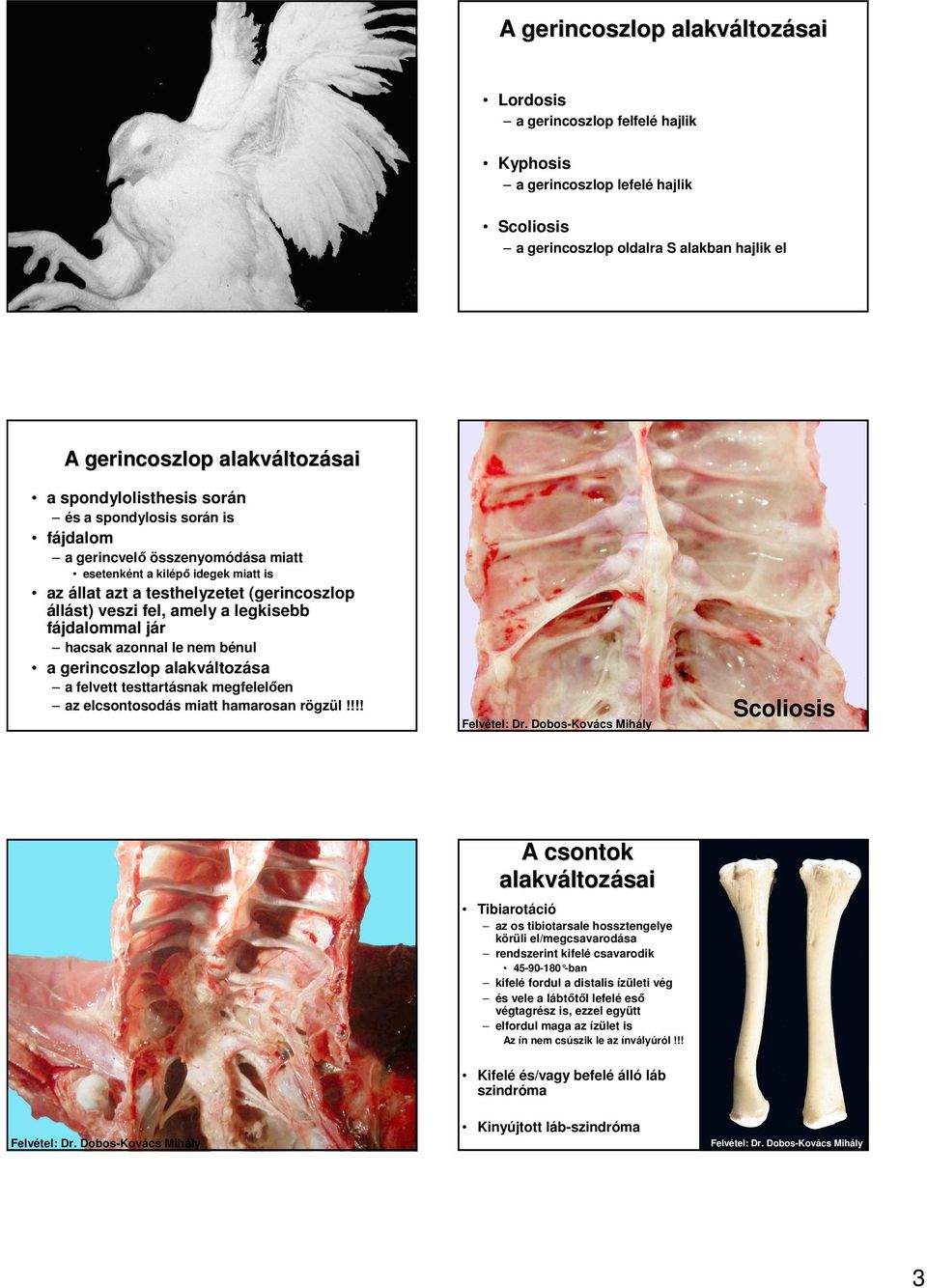 a legkisebb fájdalommal jár hacsak azonnal le nem bénul a gerincoszlop alakváltozása a felvett testtartásnak megfelelıen az elcsontosodás miatt hamarosan rögzül!