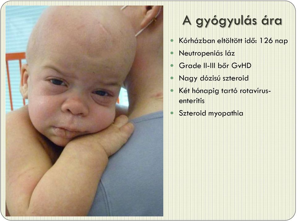 bőr GvHD Nagy dózisú szteroid Két