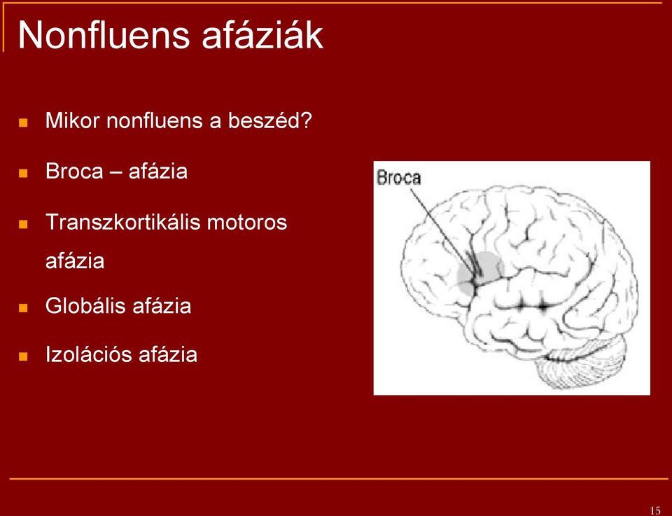 Broca afázia Transzkortikális