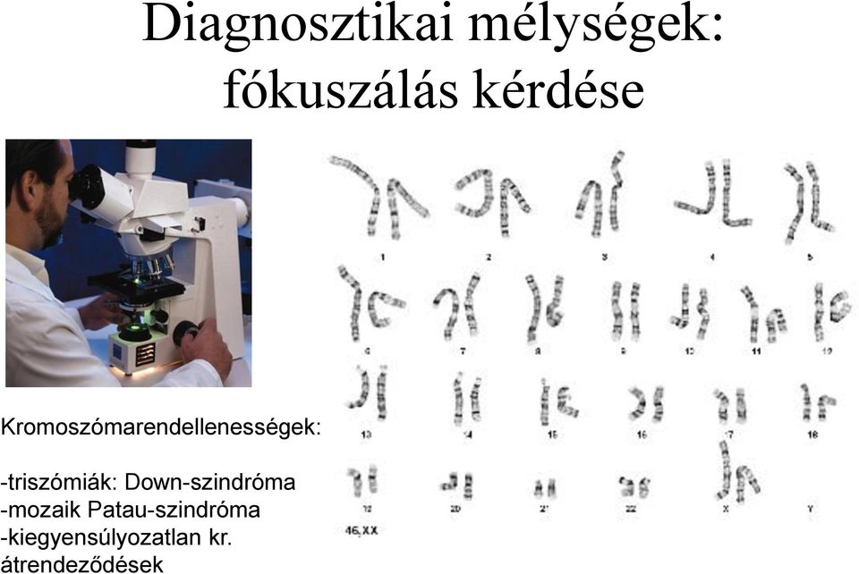 -triszómiák: Down-szindróma -mozaik