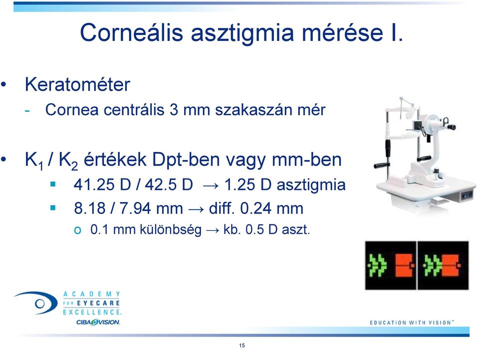 / K 2 értékek Dpt-ben vagy mm-ben 41.25 D / 42.5 D 1.