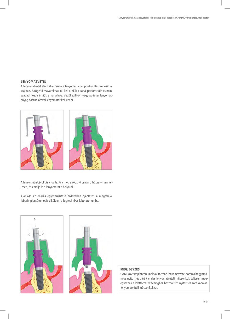 LENYOMATVÉTEL, HARAPÁSVÉTEL ÉS IDEIGLENES PÓTLÁS KÉSZÍTÉSE CAMLOG  IMPLANTÁTUMOK ESETÉN. a perfect fit - PDF Ingyenes letöltés