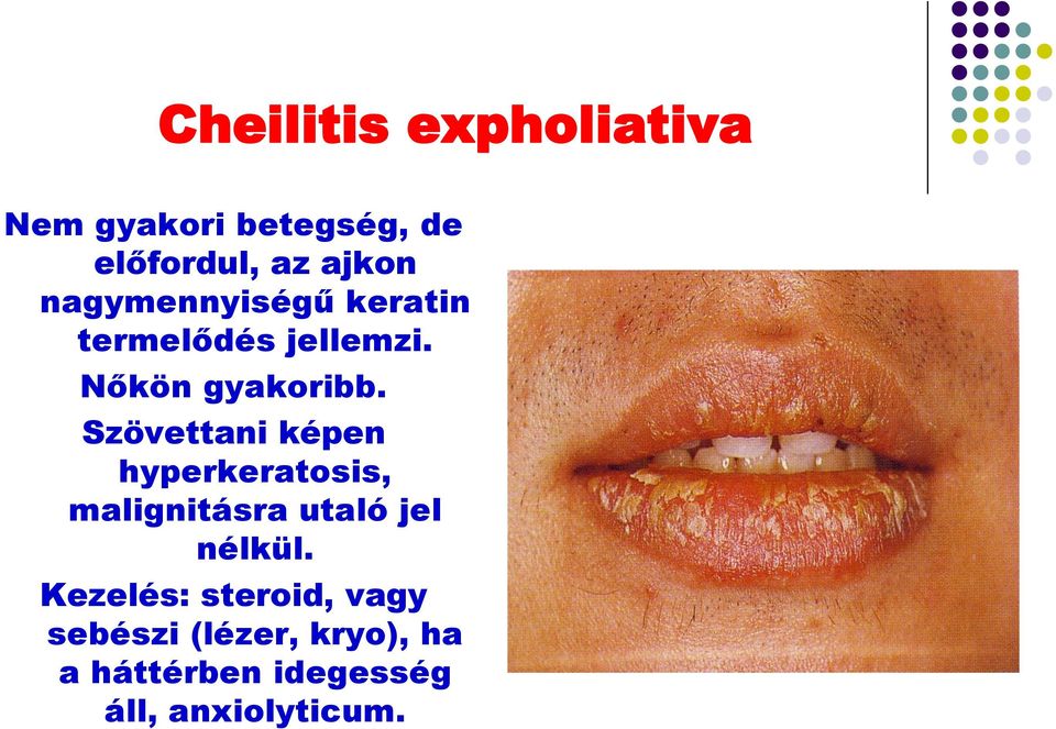 Szövettani képen hyperkeratosis, malignitásra utaló jel nélkül.