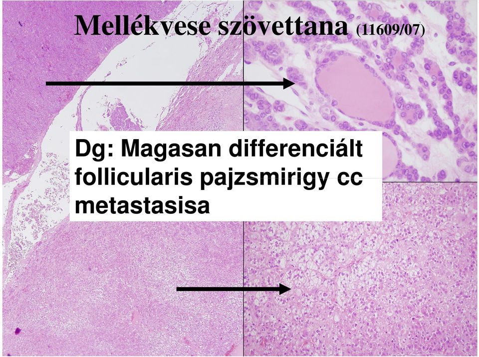 differenciált