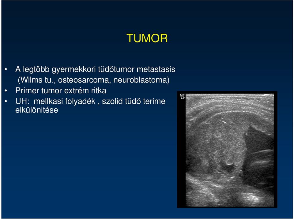 , osteosarcoma, neuroblastoma) Primer