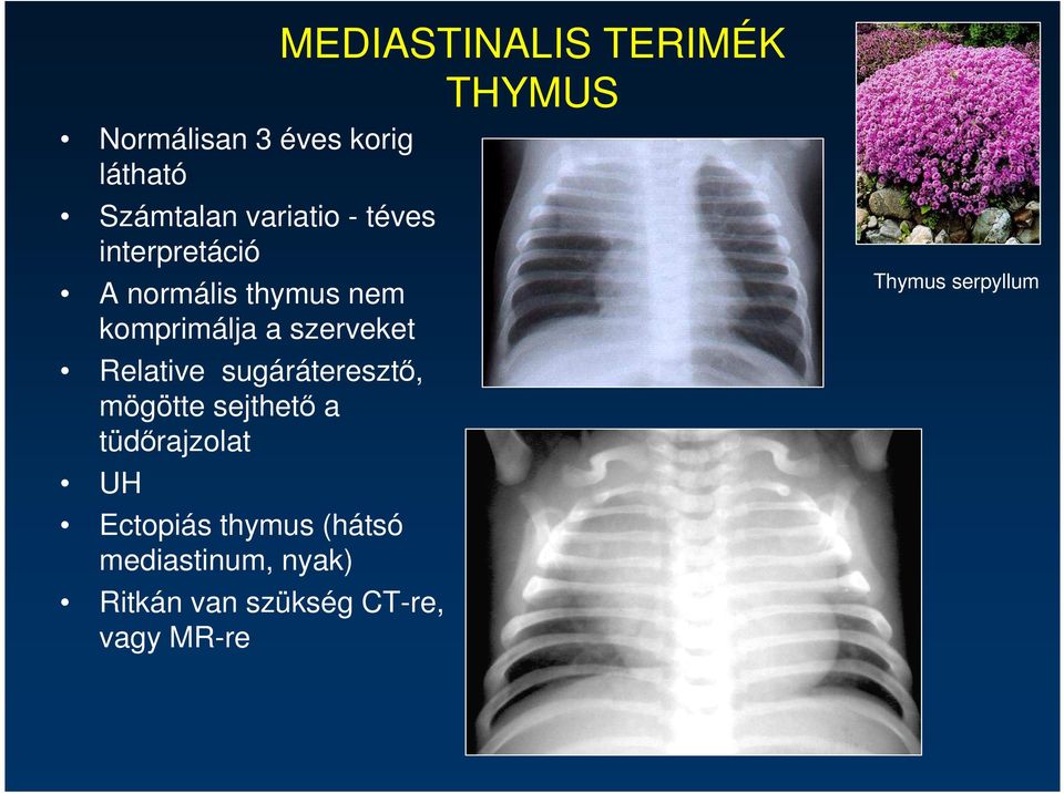 szerveket Relative sugáráteresztı, mögötte sejthetı a tüdırajzolat UH