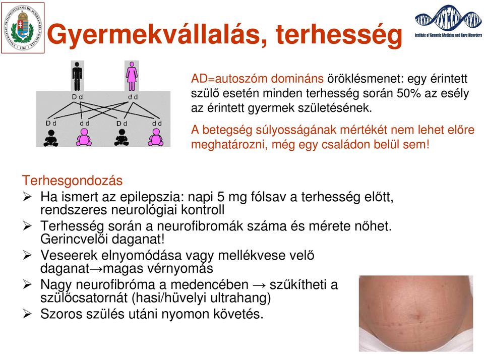 Terhesgondozás Ha ismert az epilepszia: napi 5 mg fólsav a terhesség előtt, rendszeres neurológiai kontroll Terhesség során a neurofibromák száma és