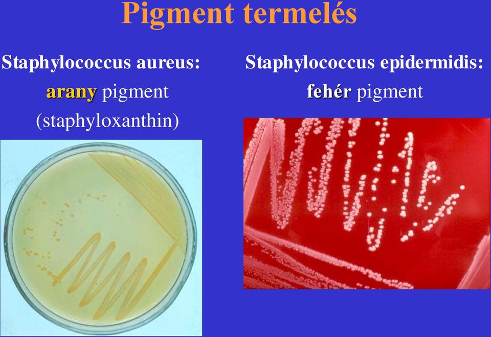 pigment (staphyloxanthin)