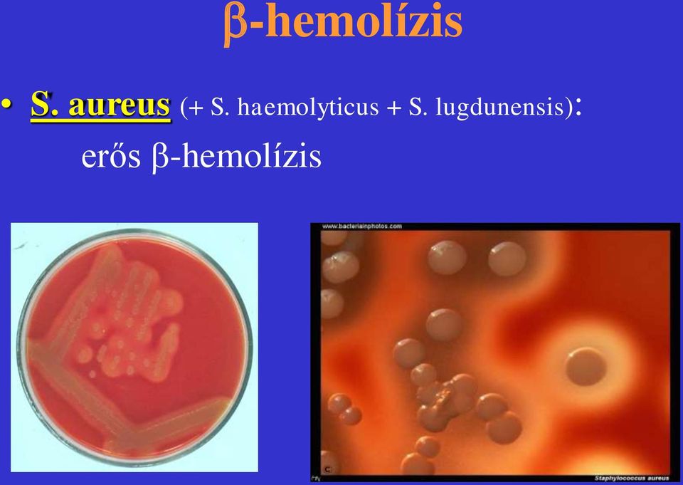 haemolyticus + S.