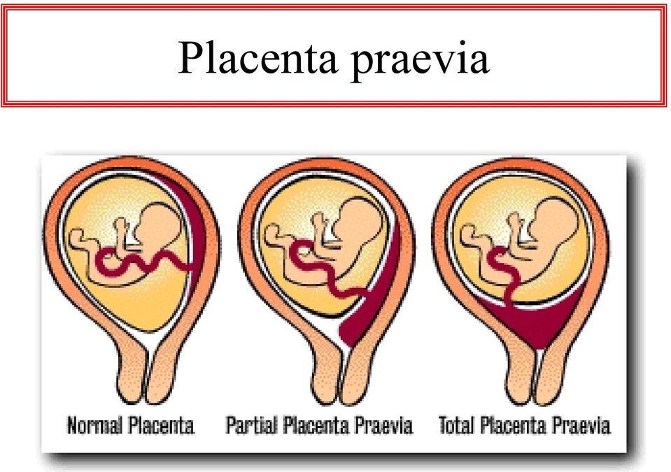 placenta ízületi kezelés
