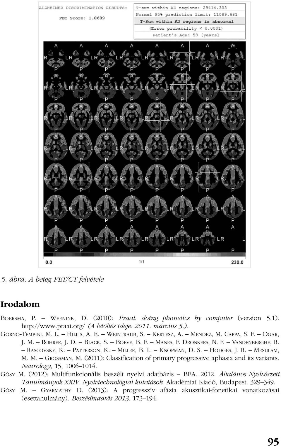 KNOPMAN, D. S. HODGES, J. R. MESULAM, M. M. GROSSMAN, M. (2011): Classification of primary progressive aphasia and its variants. Neurology, 15, 1006 1014. GÓSY M.