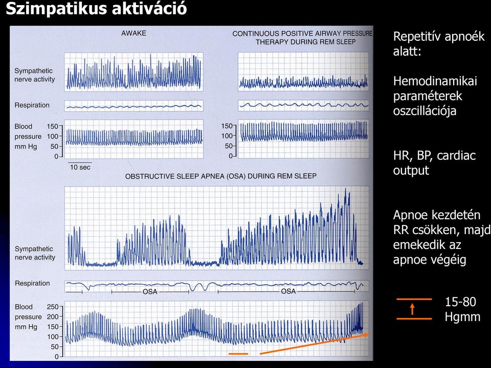 oszcillációja HR, BP, cardiac output Apnoe