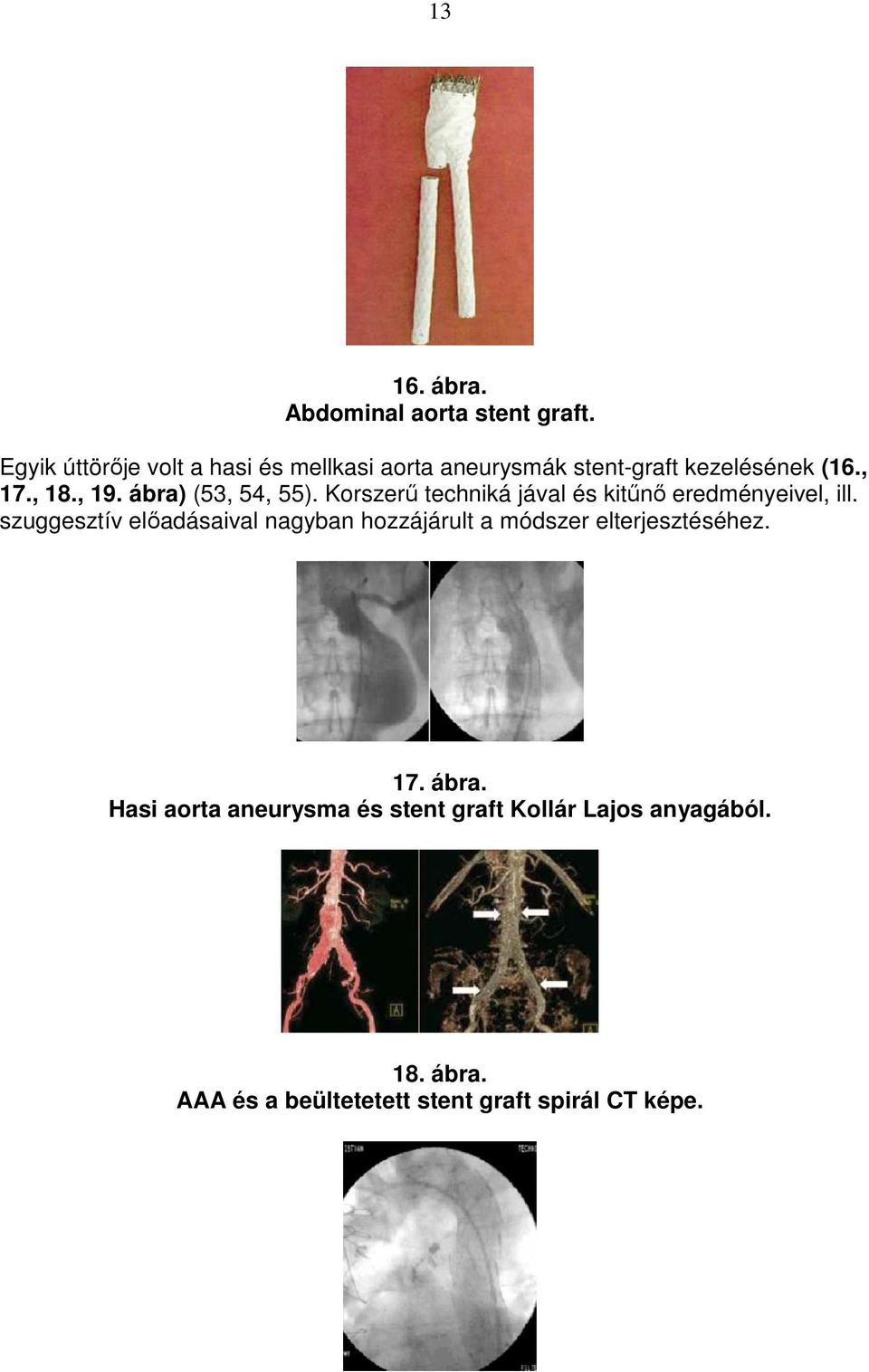 ábra) (53, 54, 55). Korszerő techniká jával és kitőnı eredményeivel, ill.