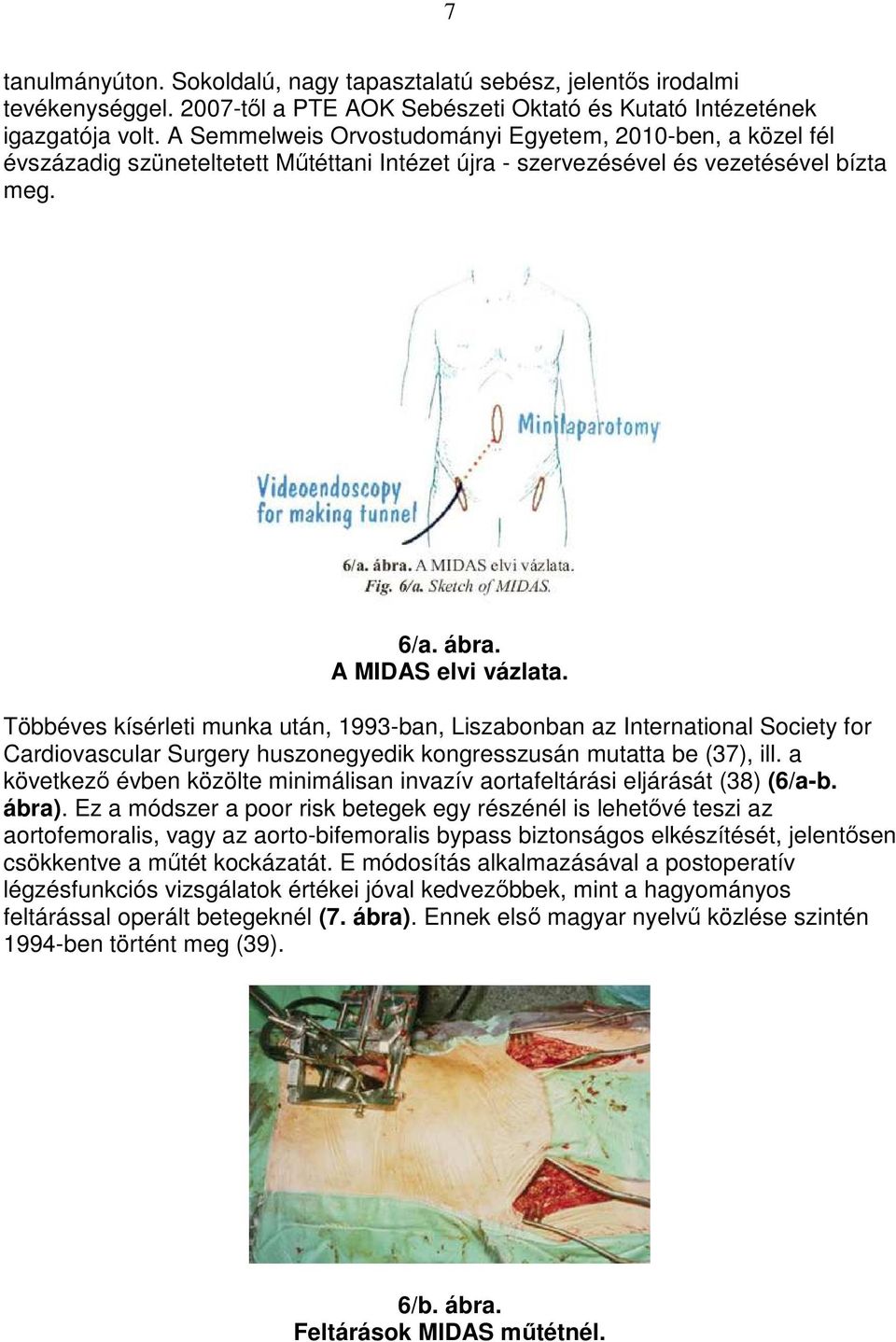 Többéves kísérleti munka után, 1993-ban, Liszabonban az International Society for Cardiovascular Surgery huszonegyedik kongresszusán mutatta be (37), ill.