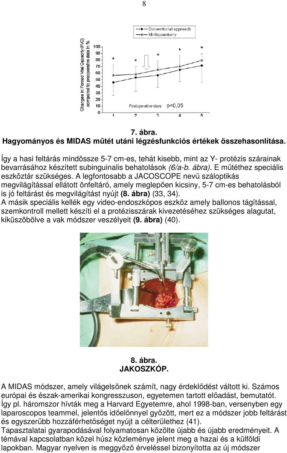 A legfontosabb a JACOSCOPE nevő száloptikás megvilágítással ellátott önfeltáró, amely meglepıen kicsiny, 5-7 cm-es behatolásból is jó feltárást és megvilágítást nyújt (8. ábra) (33, 34).