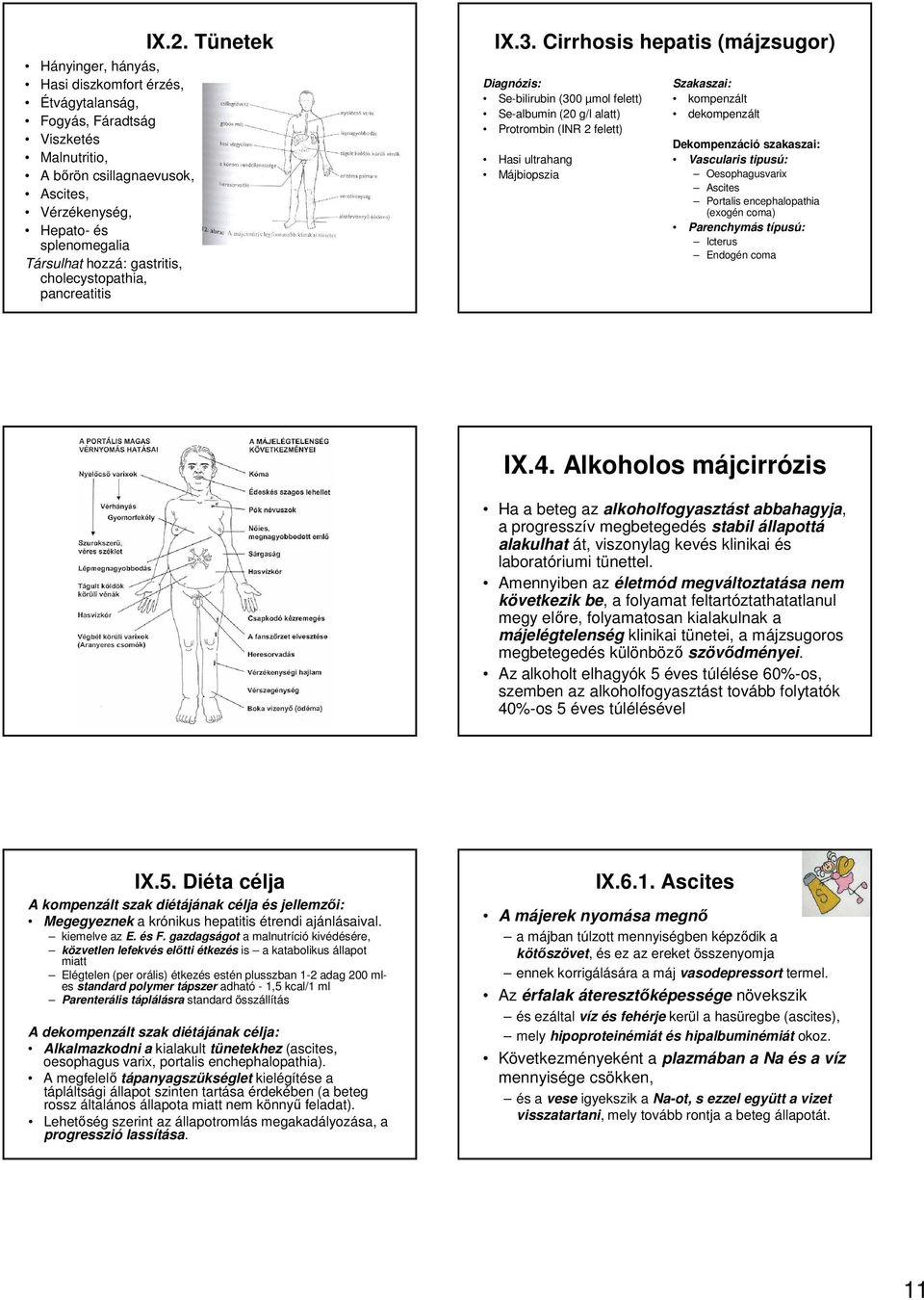 Cirrhosis hepatis (májzsugor) Diagnózis: Se-bilirubin (300 µmol felett) Se-albumin (20 g/l alatt) Protrombin (INR 2 felett) Hasi ultrahang Májbiopszia Szakaszai: kompenzált dekompenzált Dekompenzáció