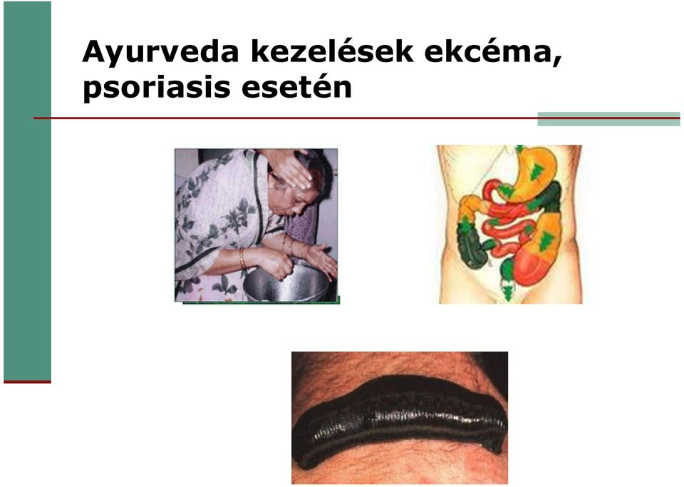 ekcéma,