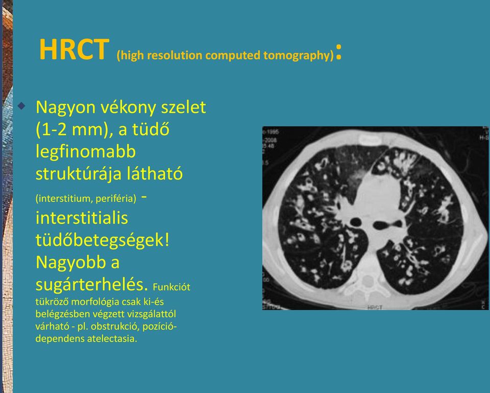 tüdőbetegségek! Nagyobb a sugárterhelés.