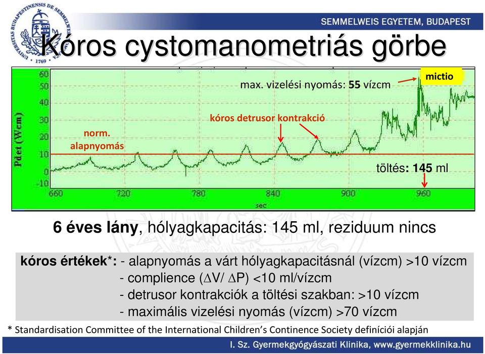 - alapnyomás a várt hólyagkapacitásnál (vízcm) >10 vízcm - complience ( V/ P) <10 ml/vízcm - detrusor kontrakciók a