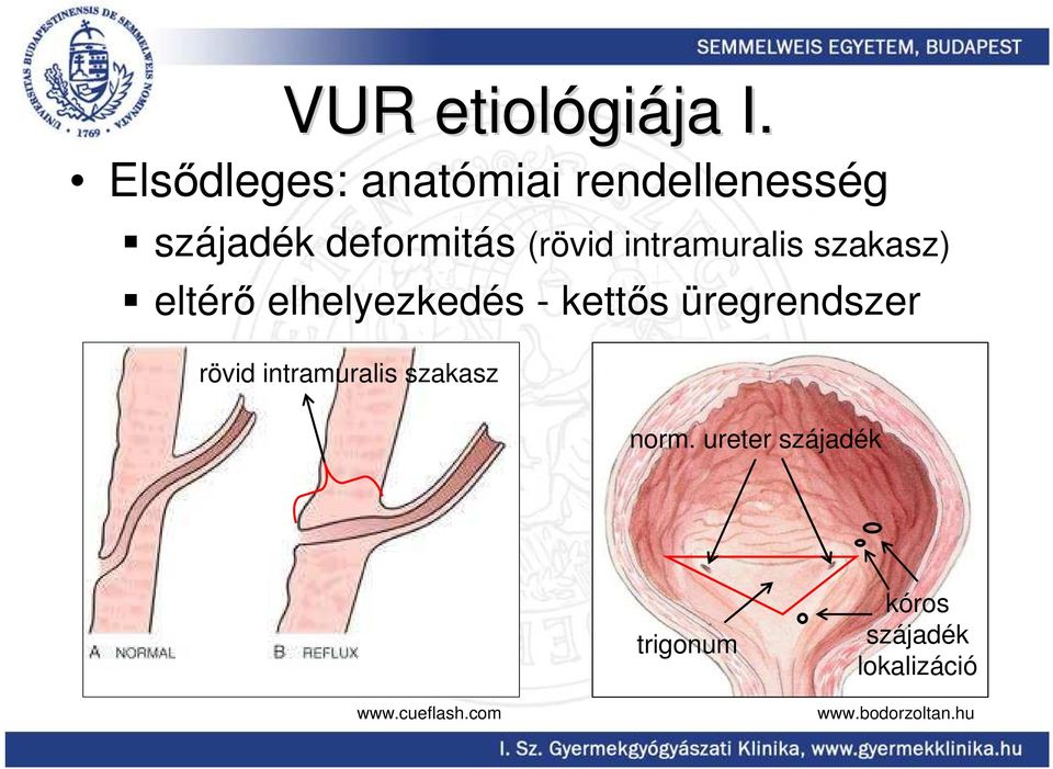 intramuralis szakasz) eltérı elhelyezkedés - kettıs üregrendszer