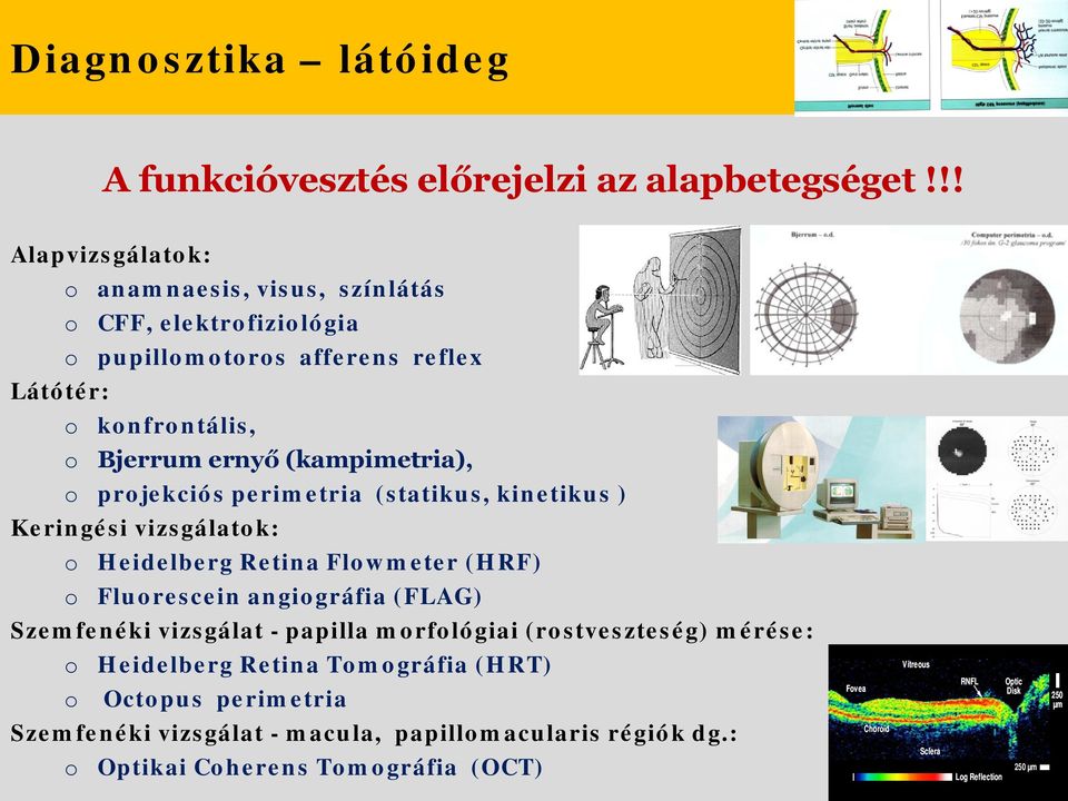 prjekciós perimetria (statikus, kinetikus ) Keringési vizsgálatk: Heidelberg Retina Flwmeter (HRF) Flurescein angigráfia (FLAG) Szemfenéki vizsgálat -