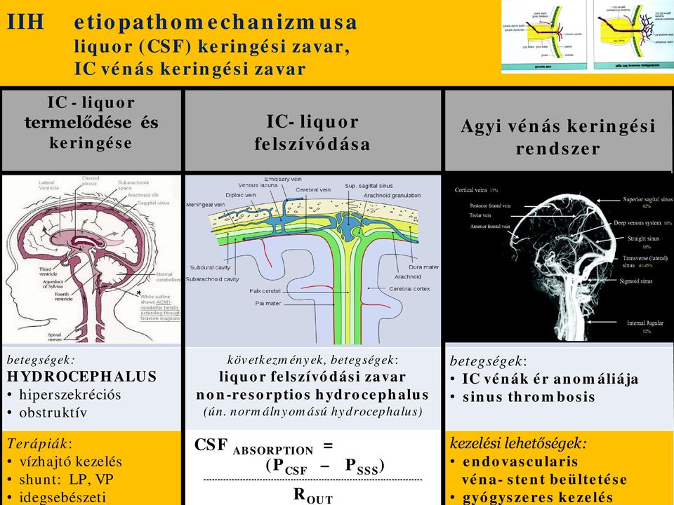 gyógyszeres kezelés IC - liqur termelődése és keringése IC- liqur felszívódása Agyi vénás keringési rendszer betegségek: HYDROCEPHALUS hiperszekréciós