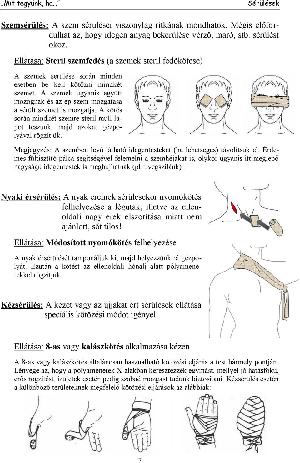 A szemek ugyanis együtt mozognak és az ép szem mozgatása a sérült szemet is mozgatja. A kötés során mindkét szemre steril mull lapot teszünk, majd azokat gézpólyával rögzítjük.