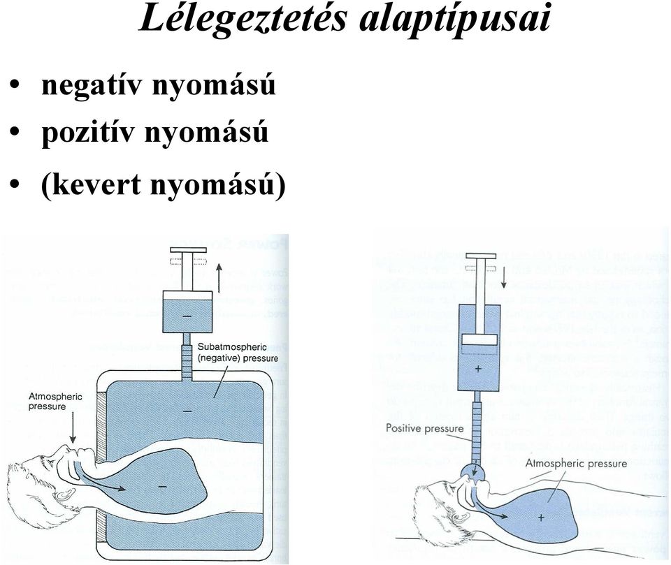 negatív nyomású