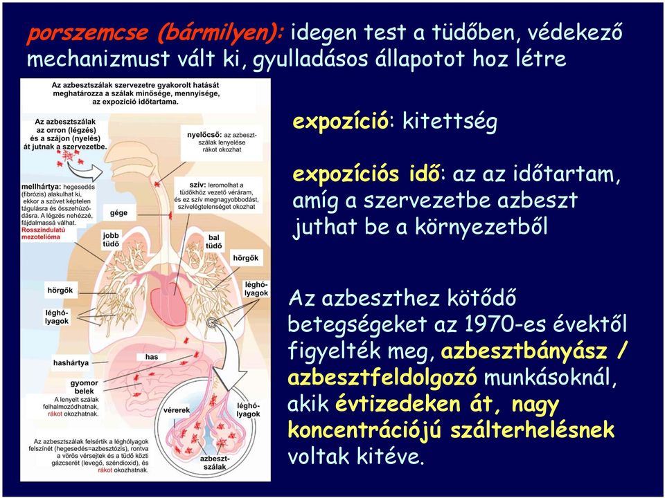 a környezetből Az azbeszthez kötődő betegségeket az 1970-es évektől figyelték meg, azbesztbányász /