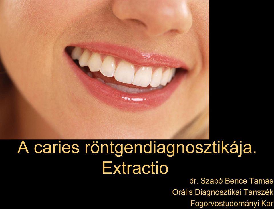 Extractio dr.