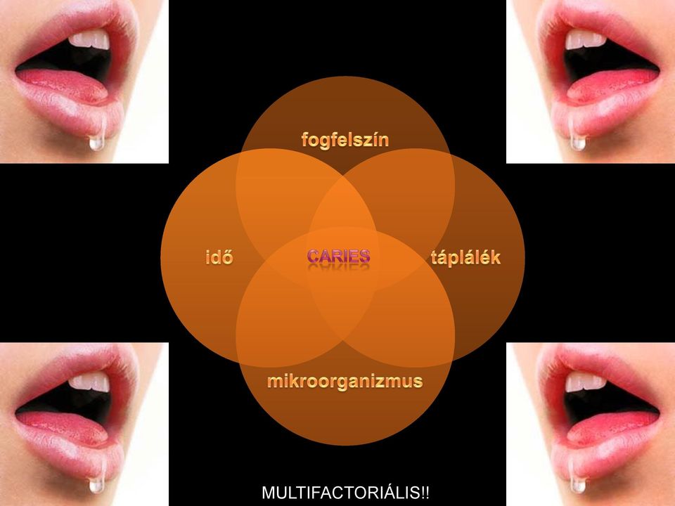 susceptible tooth