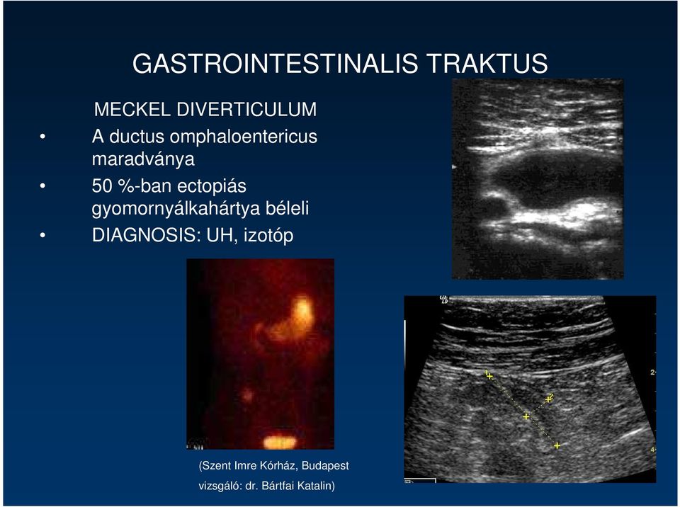 gyomornyálkahártya béleli DIAGNOSIS: UH, izotóp