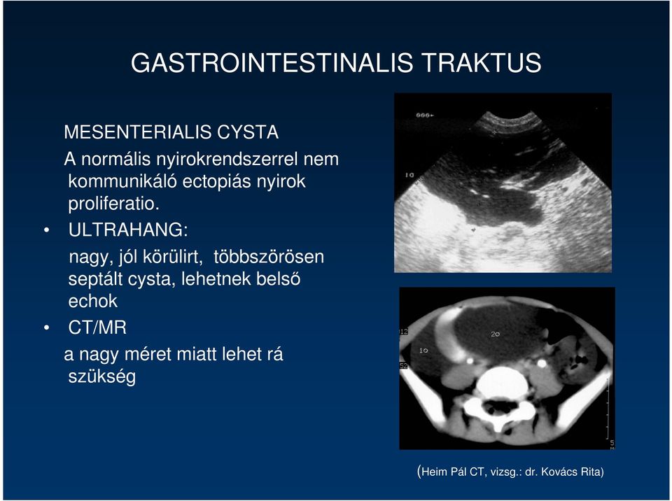 ULTRAHANG: nagy, jól körülirt, többszörösen septált cysta, lehetnek